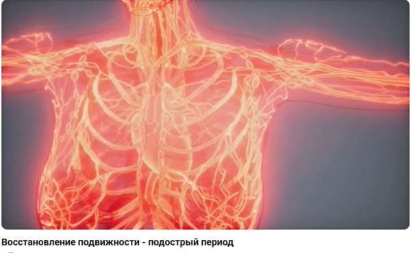 Восстановление подвижности - подострый период